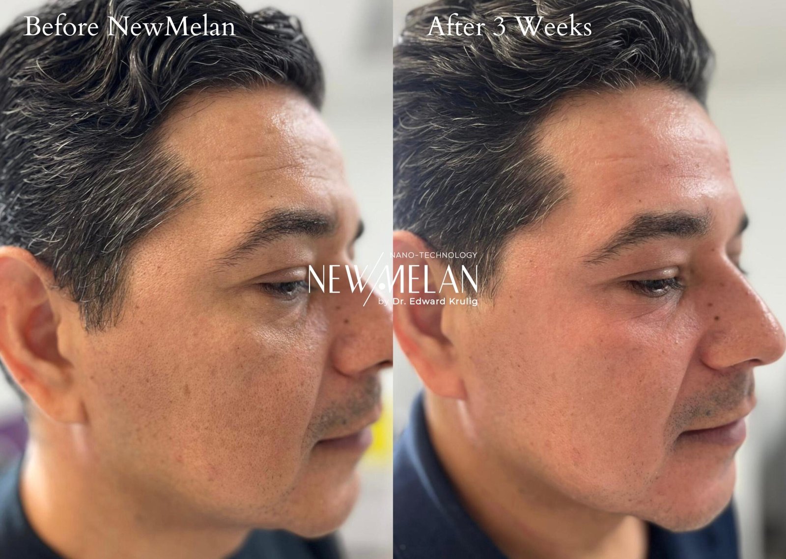 74c5a298-3d68-4f59-bb1b-6aa42e3631fb